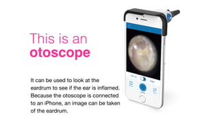 otoscope
This is an
It can be used to look at the
eardrum to see if the ear is inﬂamed.
Because the otoscope is connected
to an iPhone, an image can be taken
of the eardrum.
 