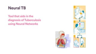 Neural TB
Tool that aids in the
diagnosis ofTuberculosis
using Neural Networks
 