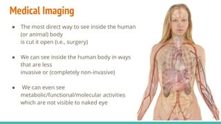 Medical Imaging
● The most direct way to see inside the human
(or animal) body
is cut it open (i.e., surgery)
● We can see inside the human body in ways
that are less
invasive or (completely non-invasive)
● We can even see
metabolic/functional/molecular activities
which are not visible to naked eye
24
 