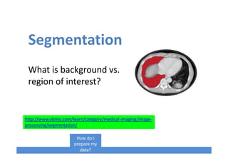Segmentation
What is background vs.
region of interest?
How do I
prepare my
data?
http://www.vbmis.com/learn/category/medical-imaging/image-
processing/segmentation/
 
