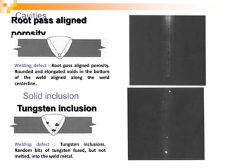 Cavities
Root pass aligned
porosity
Welding defect : Root pass aligned porosity.
Rounded and elongated voids in the bottom
of the weld aligned along the weld
centerline.
Solid inclusion
Tungsten inclusion
Welding defect : Tungsten inclusions.
Random bits of tungsten fused, but not
melted, into the weld metal.
 