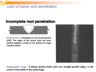 Lack of fusion and penetration
Incomplete root penetration
Welding defect : Incomplete or lack of penetration
(LOP). The edges of the pieces have not been
welded together, usually at the bottom of single
V-groove welds.
Radiographic image : A darker density band, with very straight parallel edges, in the
center of the width of the weld image.
 