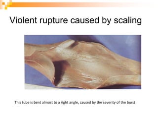 Violent rupture caused by scaling
This tube is bent almost to a right angle, caused by the severity of the burst
 