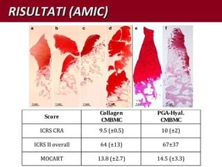 RISULTATI (AMIC)RISULTATI (AMIC)
Score
Collagen
CMBMC
PGA-Hyal.
CMBMC
ICRS CRA 9.5 (±0.5) 10 (±2)
ICRS II overall 64 (±13) 67±37
MOCART 13.8 (±2.7) 14.5 (±3.3)
 