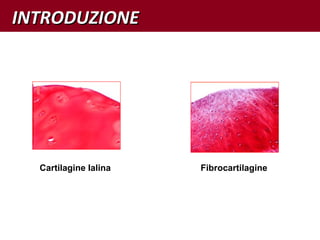 Cartilagine Ialina Fibrocartilagine
INTRODUZIONEINTRODUZIONE
 