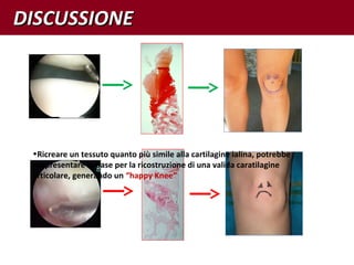 DISCUSSIONEDISCUSSIONE
•Ricreare un tessuto quanto più simile alla cartilagine ialina, potrebbe
rappresentare la base per la ricostruzione di una valida caratilagine
articolare, generando un “happy Knee”
 