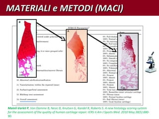 Mainil-Varlet P, Van Damme B, Nesic D, Knutsen G, Kandel R, Roberts S. A new histology scoring system
for the assessment of the quality of human cartilage repair: ICRS II.Am J Sports Med. 2010 May;38(5):880-
90.
MATERIALI e METODI (MACI)MATERIALI e METODI (MACI)
 