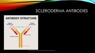Advanced B Cell Depletion Therapies in Scleroderma: CAR T and BiTE ...
