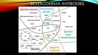 Advanced B Cell Depletion Therapies in Scleroderma: CAR T and BiTE ...