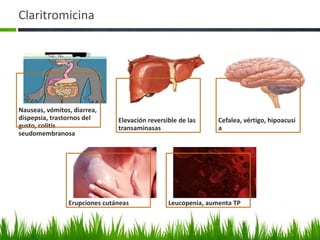 Claritromicina




Nauseas, vómitos, diarrea,
dispepsia, trastornos del      Elevación reversible de las     Cefalea, vértigo, hipoacusi
gusto, colitis                 transaminasas                   a
seudomembranosa




                Erupciones cutáneas             Leucopenia, aumenta TP
 