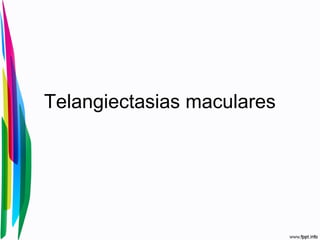 Telangiectasias maculares
 