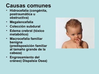 Causas comunes Hidrocefalia (congénita, postraumática u obstructiva) Megalencefalia Colección subdural Edema crebral (tóxico metabólico) Macrocefalia familiar benigna (predisposición familiar al tamaño grande de la cabeza) Engrosamiento del cráneo) Dispalsia Osea)
