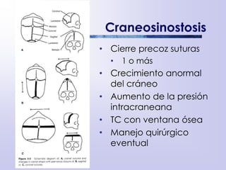 Craneosinostosis
• Cierre precoz suturas
• 1 o más
• Crecimiento anormal
del cráneo
• Aumento de la presión
intracraneana
• TC con ventana ósea
• Manejo quirúrgico
eventual
 