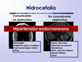 Hidrocefalia
Comunicante:
no obstructiva
No comunicante:
obstructiva
Meningitis
Papiloma plexo coroideo
Post hemorrágica (HSA)
Otras
Tumor, Absceso
Estenosis acueducto
Hematoma
Malf. vena de Galeno
Dandy Walker
Otras
Hipertensión endocraneana
 