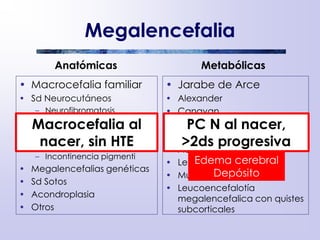Megalencefalia
Anatómicas
• Macrocefalia familiar
• Sd Neurocutáneos
– Neurofibromatosis
– Esclerosis Tuberosa
– Hipomelanosis de Ito
– Sd Nevus epidérmico
– Incontinencia pigmenti
• Megalencefalias genéticas
• Sd Sotos
• Acondroplasia
• Otros
Metabólicas
• Jarabe de Arce
• Alexander
• Canavan
• Galactosemia
• Gangliosidosis
• Ac Glutárica tipo I
• Leucod. metacromática
• Mucopolisacaridosis
• Leucoencefalotía
megalencefalica con quistes
subcorticales
Macrocefalia al
nacer, sin HTE
PC N al nacer,
>2ds progresiva
Edema cerebral
Depósito
 