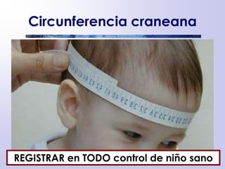 Circunferencia craneana
REGISTRAR en TODO control de niño sano
 