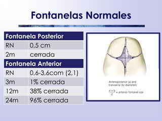Fontanelas Normales
Fontanela Posterior
RN 0,5 cm
2m cerrada
Fontanela Anterior
RN 0,6-3,6com (2,1)
3m 1% cerrada
12m 38% cerrada
24m 96% cerrada
 