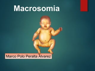 Macrosomia
Marco Polo Peralta Álvarez
 