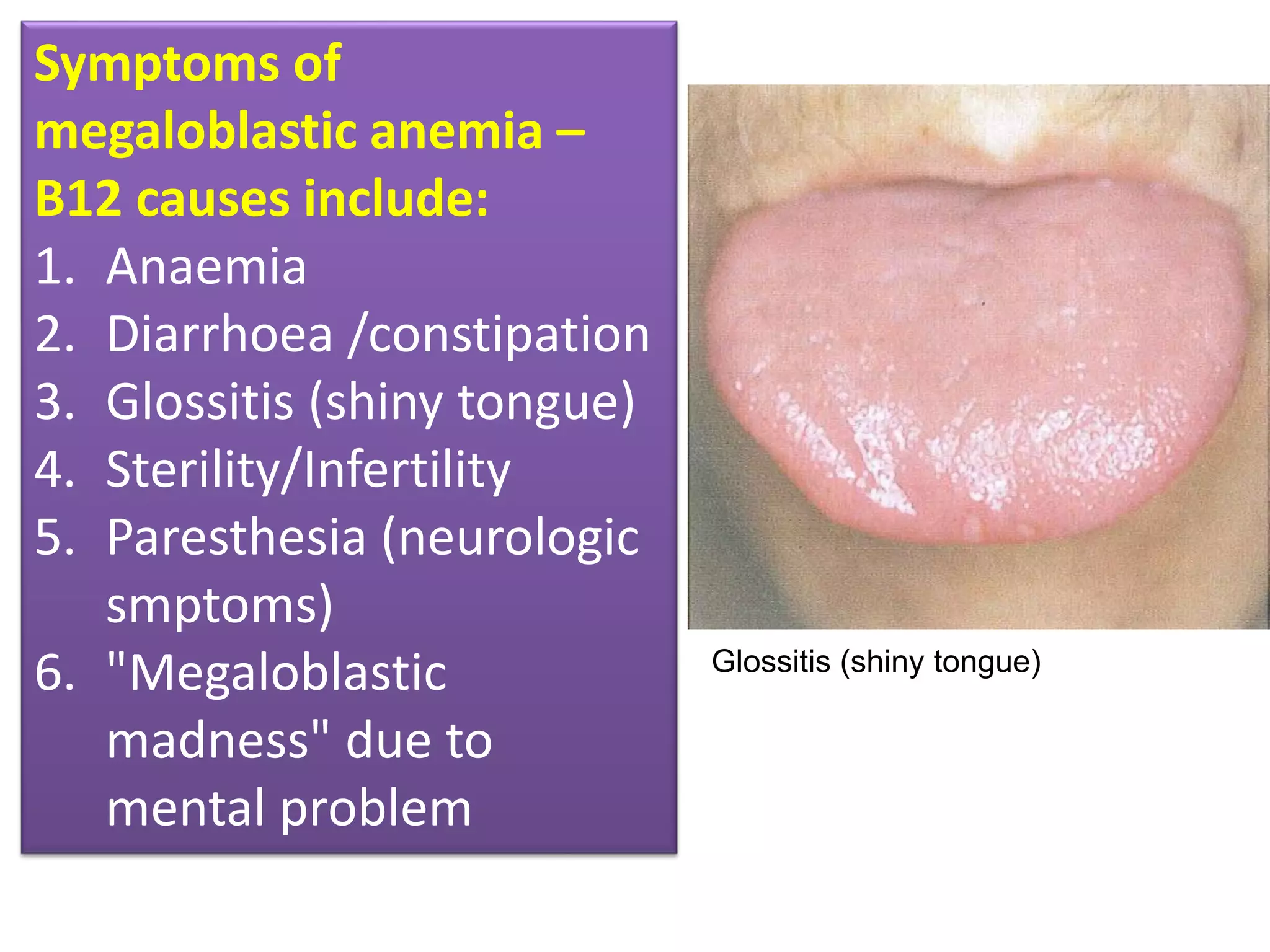Symptoms of
megaloblastic anemia –
B12 causes include:
1. Anaemia
2. Diarrhoea /constipation
3. Glossitis (shiny tongue)
4. Sterility/Infertility
5. Paresthesia (neurologic
smptoms)
6. "Megaloblastic
madness" due to
mental problem
Glossitis (shiny tongue)
 