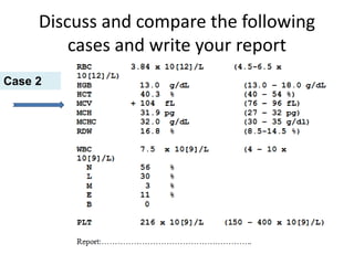 Discuss and compare the following
cases and write your report
Case 2
 