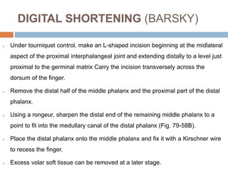 DIGITAL SHORTENING (BARSKY)
 Under tourniquet control, make an L-shaped incision beginning at the midlateral
aspect of the proximal interphalangeal joint and extending distally to a level just
proximal to the germinal matrix Carry the incision transversely across the
dorsum of the finger.
 Remove the distal half of the middle phalanx and the proximal part of the distal
phalanx.
 Using a rongeur, sharpen the distal end of the remaining middle phalanx to a
point to fit into the medullary canal of the distal phalanx (Fig. 79-58B).
 Place the distal phalanx onto the middle phalanx and fix it with a Kirschner wire
to recess the finger.
 Excess volar soft tissue can be removed at a later stage.
 