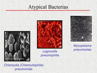 Atypical Bacterias
Mycoplasma
pneumoniae
Legionella
pneumophila
Chlamydia (Chlamydophila)
pneumoniae
 