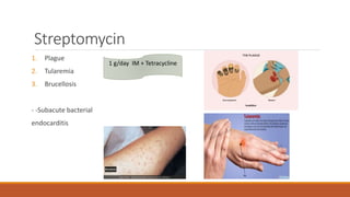 Streptomycin
1. Plague
2. Tularemia
3. Brucellosis
- -Subacute bacterial
endocarditis
1 g/day IM + Tetracycline
 