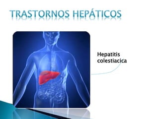 Hepatitis
colestiacica
 