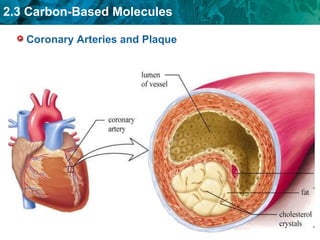 Coronary Arteries and Plaque 