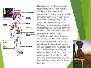 Kwashiorkor, a Ghanaian word
meaning the disease that the first
child gets when the new child
comes, is typically seen when a child
is weaned from high-protein breast
milk onto a carbohydrate food
source with insufficient protein.
Children with this disease, which is
characterized by a swollen belly due
to edema (fluid retention), are weak,
grow poorly, and are more
susceptible to infectious diseases,
which may result in fatal diarrhea.
Other symptoms of kwashiorkor
include apathy, hair discoloration,
and dry, peeling skin with sores that
fail to heal. Weight loss may be
disguised because of the presence of
edema, enlarged fatty liver, and
intestinal parasites; moreover, there
may be little wasting of muscle and
body fat.
 
