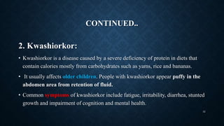 CONTINUED..
2. Kwashiorkor:
• Kwashiorkor is a disease caused by a severe deficiency of protein in diets that
contain calories mostly from carbohydrates such as yams, rice and bananas.
• It usually affects older children. People with kwashiorkor appear puffy in the
abdomen area from retention of fluid.
• Common symptoms of kwashiorkor include fatigue, irritability, diarrhea, stunted
growth and impairment of cognition and mental health.
32
 