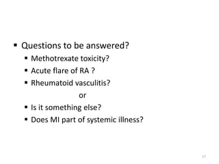  Questions to be answered?
 Methotrexate toxicity?
 Acute flare of RA ?
 Rheumatoid vasculitis?
or
 Is it something else?
 Does MI part of systemic illness?
17
 