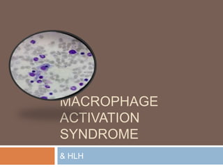 MACROPHAGE
ACTIVATION
SYNDROME
& HLH
 