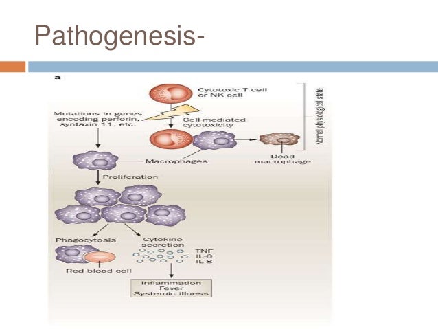 Macrophage Activation Syndrome