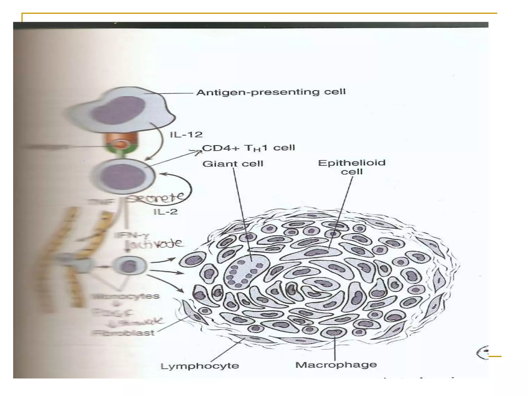 Picture of Macrophage in Health and Disease.ppt