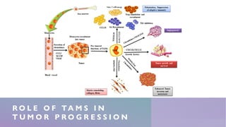 Macrophage polarization in Cancer | PDF