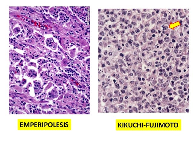 Macrophages