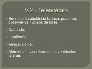  Emmeio à substância branca, podemos
 observar os núcleos da base.
 Caudado.

 Lentiforme.

 Amigadalóide.

 Além deles, visualizamos os ventrículos
 laterais
 
