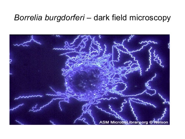 Macroscopic and microscopic examination in bacteriology