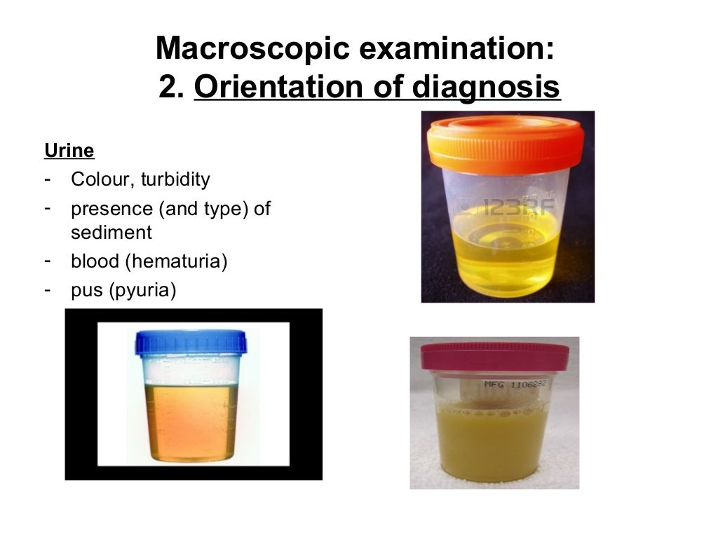 Macroscopic and microscopic examination in bacteriology