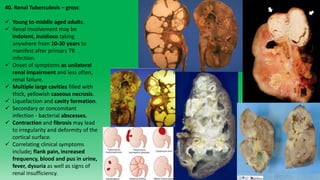 PMU third/fourth year Clinical pathoanatomy Part 3 | PPTX