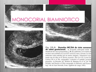 MONOCORIAL BIAMNIOTICO
 