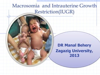 Macrosomia and Intrauterine Growth
Restriction(IUGR)
DR Manal Behery
Zagazig University,
2013
 