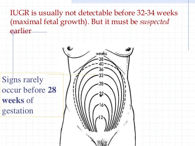 macrosomia and iugr with case study for undergraduare estimated fetal weight charts