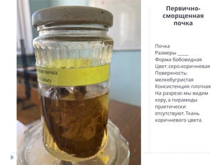 -
Первично
сморщенная
почка
Почка
____
Размеры
Форма бобовидная
: -
Цвет серо коричневая
:
Поверхность
мелкобугристая
:
Консистенция плотная
:
На разрезе мы видим
,
кору а пирамиды
практически
.
отсутствуют Ткань
.
коричневого цвета
 