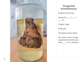 Congenital
bronchiectases
Fragment of the lung,
dimensions ___ ___
х х
___ cm
Irregular shape
Color gray
Consistency dense-elastic
The section shows sharply
expanded bronchial lumens
about ___ mm in diameter.
 