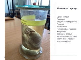 Легочное сердце
Орган сердца
___
Размеры
наружная поверхность
Гладкая
отмечается
гипертрофия правого
желудочка
верхушка сердца
закруглена вследствие
увеличение правых
отделов сердца
 