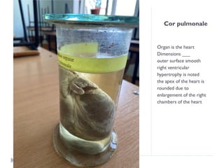 Cor pulmonale
Organ is the heart
Dimensions ___
outer surface smooth
right ventricular
hypertrophy is noted
the apex of the heart is
rounded due to
enlargement of the right
chambers of the heart
 