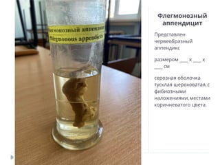 Флегмонозный
аппендицит
Представлен
червеобразный
аппендикс
___ ___
размером х х
___ см
серозная оболочка
,
тусклая шероховатая с
фибиозными
,
наложениями местами
.
коричневатого цвета
 