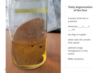 Fatty degeneration
of the liver
A section of the liver is
presented
dimensions ___ x ___ x
___ cm
the shape is irregular
yellow color thin, smooth,
shiny capsule
yellowish-orange
homogeneous in cross
section
flabby consistency
 